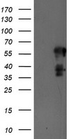SCHIP1 Antibody - HEK293T cells were transfected with the pCMV6-ENTRY control (Left lane) or pCMV6-ENTRY SCHIP1 (Right lane) cDNA for 48 hrs and lysed. Equivalent amounts of cell lysates (5 ug per lane) were separated by SDS-PAGE and immunoblotted with anti-SCHIP1.