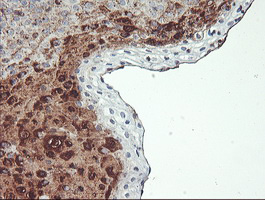 SCHIP1 Antibody - IHC of paraffin-embedded Human tonsil using anti-SCHIP1 mouse monoclonal antibody. (Heat-induced epitope retrieval by 10mM citric buffer, pH6.0, 100C for 10min).