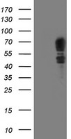 SCHIP1 Antibody - HEK293T cells were transfected with the pCMV6-ENTRY control (Left lane) or pCMV6-ENTRY SCHIP1 (Right lane) cDNA for 48 hrs and lysed. Equivalent amounts of cell lysates (5 ug per lane) were separated by SDS-PAGE and immunoblotted with anti-SCHIP1.