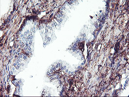 SCHIP1 Antibody - IHC of paraffin-embedded Human prostate tissue using anti-SCHIP1 mouse monoclonal antibody. (Heat-induced epitope retrieval by 10mM citric buffer, pH6.0, 100C for 10min).
