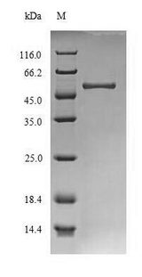 AGN1 (S. pombe) Protein - (Tris-Glycine gel) Discontinuous SDS-PAGE (reduced) with 5% enrichment gel and 15% separation gel.