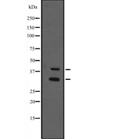 Schnurri-2 / HIVEP2 Antibody - Western blot analysis of MIBP1 expression in immunising recombinant protein. The lane on the left is treated with the antigen-specific peptide.