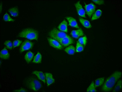 SCIMP Antibody - Immunofluorescence staining of Hela cells diluted at 1:166, counter-stained with DAPI. The cells were fixed in 4% formaldehyde, permeabilized using 0.2% Triton X-100 and blocked in 10% normal Goat Serum. The cells were then incubated with the antibody overnight at 4°C.The Secondary antibody was Alexa Fluor 488-congugated AffiniPure Goat Anti-Rabbit IgG (H+L).