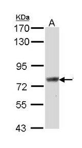 SCIN Antibody - Sample (30 ug of whole cell lysate). A: Hep G2 . 7.5% SDS PAGE. SCIN antibody diluted at 1:1000.