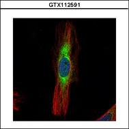 SCIN Antibody - Confocal immunofluorescence analysis (Olympus FV10i) of methanol-fixed HeLa using SCIN antibody (Green) at 1:500 dilution. Alpha-tubulin filaments were labeled with alpha-tubulin antibody (Red) at 1:2000.