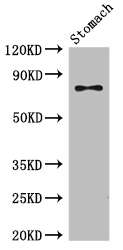 SCIN Antibody - Positive WB detected in:Mouse stomach tissue;All lanes:SCIN antibody at 3.5ug/ml;Secondary;Goat polyclonal to rabbit IgG at 1/50000 dilution;Predicted band size: 81,66,53 kDa;Observed band size: 81 kDa;