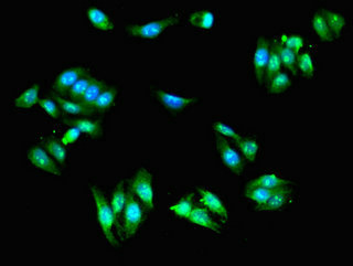 SCIN Antibody - Immunofluorescent analysis of HepG2 cells using SCIN Antibody at dilution of 1:100 and Alexa Fluor 488-congugated AffiniPure Goat Anti-Rabbit IgG(H+L)