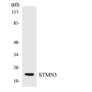 SCLIP / STMN3 Antibody - Western blot analysis of the lysates from K562 cells using STMN3 antibody.