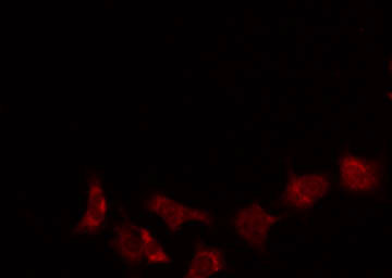 SCLIP / STMN3 Antibody - Staining 293 cells by IF/ICC. The samples were fixed with PFA and permeabilized in 0.1% Triton X-100, then blocked in 10% serum for 45 min at 25°C. The primary antibody was diluted at 1:200 and incubated with the sample for 1 hour at 37°C. An Alexa Fluor 594 conjugated goat anti-rabbit IgG (H+L) Ab, diluted at 1/600, was used as the secondary antibody.