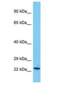 SCLT1 Antibody - SCLT1 antibody Western Blot of HepG2. Antibody dilution: 1 ug/ml.  This image was taken for the unconjugated form of this product. Other forms have not been tested.
