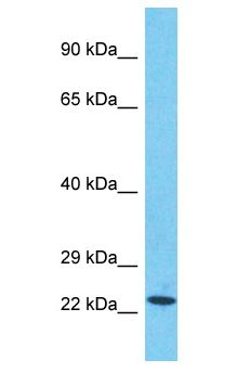 SCLT1 Antibody - SCLT1 antibody Western Blot of HepG2. Antibody dilution: 1 ug/ml.  This image was taken for the unconjugated form of this product. Other forms have not been tested.