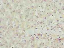 SCLT1 Antibody - Immunohistochemistry of paraffin-embedded human liver tissue using antibody at dilution of 1:100.
