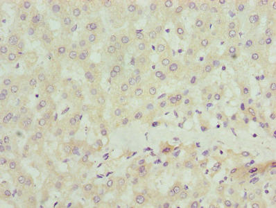 SCLT1 Antibody - Immunohistochemistry of paraffin-embedded human liver tissue using SCLT1 Antibody at dilution of 1:100