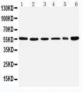 SCLY Antibody - WB of SCLY antibody. Lane 1: U87 Cell Lysate. Lane 2: HELA Cell Lysate. Lane 3: 293T Cell Lysate. Lane 4: MCF-7 Cell Lysate. Lane 5: COLO320 Cell Lysate. Lane 6: HE1080 Cell Lysate.