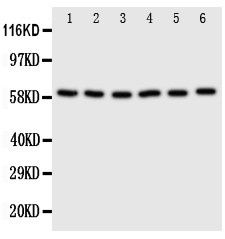 SCLY Antibody - Anti-SCLY antibody, Western blotting Lane 1: U87 Cell LysateLane 2: HELA Cell LysateLane 3: 293T Cell LysateLane 4: MCF-7 Cell LysateLane 5: COLO320 Cell LysateLane 6: HE1080 Cell Lysate
