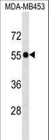 SCLY Antibody - SCLY Antibody western blot of MDA-MB453 cell line lysates (35 ug/lane). The SCLY antibody detected the SCLY protein (arrow).