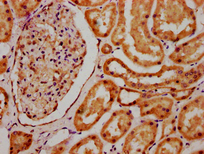 SCLY Antibody - Immunohistochemistry Dilution at 1:700 and staining in paraffin-embedded human kidney tissue performed on a Leica BondTM system. After dewaxing and hydration, antigen retrieval was mediated by high pressure in a citrate buffer (pH 6.0). Section was blocked with 10% normal Goat serum 30min at RT. Then primary antibody (1% BSA) was incubated at 4°C overnight. The primary is detected by a biotinylated Secondary antibody and visualized using an HRP conjugated SP system.