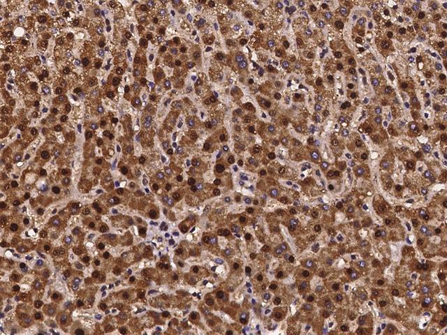 SCLY Antibody - Immunochemical staining of human SCLY in human liver with rabbit polyclonal antibody at 1:100 dilution, formalin-fixed paraffin embedded sections.