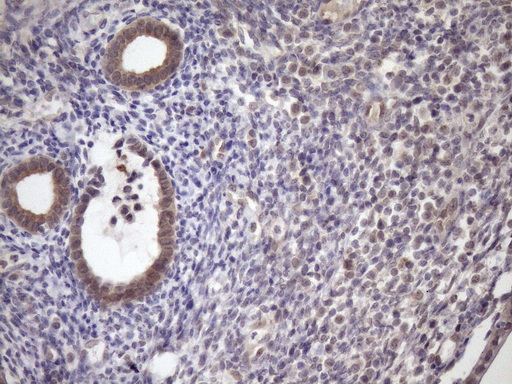 SCMH1 Antibody - Immunohistochemical staining of paraffin-embedded Carcinoma of Human pancreas tissue using anti-SCMH1 mouse monoclonal antibody. (Heat-induced epitope retrieval by Tris-EDTA, pH8.0)(1:150)