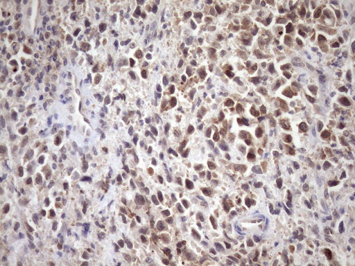 SCMH1 Antibody - Immunohistochemical staining of paraffin-embedded Human bladder tissue within the normal limits using anti-SCMH1 mouse monoclonal antibody. (Heat-induced epitope retrieval by Tris-EDTA, pH8.0)(1:150)