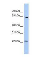 SCMH1 Antibody - SCMH1 antibody Western blot of HT1080 cell lysate. This image was taken for the unconjugated form of this product. Other forms have not been tested.