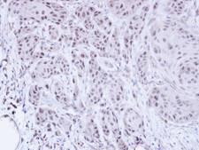 SCMH1 Antibody - IHC of paraffin-embedded Cal27 xenograft using SCMH1 antibody at 1:100 dilution.