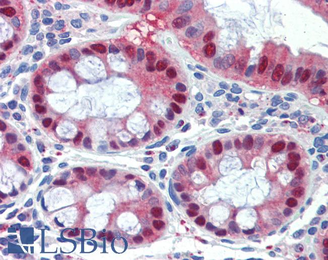 SCML1 Antibody - Anti-SCML1 antibody IHC of human colon. Immunohistochemistry of formalin-fixed, paraffin-embedded tissue after heat-induced antigen retrieval. Antibody concentration 5 ug/ml.  This image was taken for the unconjugated form of this product. Other forms have not been tested.