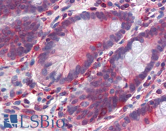 SCML1 Antibody - Anti-SCML1 antibody IHC of human small intestine. Immunohistochemistry of formalin-fixed, paraffin-embedded tissue after heat-induced antigen retrieval. Antibody concentration 5 ug/ml.  This image was taken for the unconjugated form of this product. Other forms have not been tested.