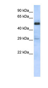 SCML1 Antibody - SCML1 antibody Western blot of HeLa lysate. This image was taken for the unconjugated form of this product. Other forms have not been tested.