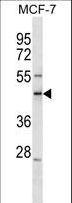 SCML1 Antibody - SCML1 Antibody western blot of MCF-7 cell line lysates (35 ug/lane). The SCML1 Antibody detected the SCML1 protein (arrow).