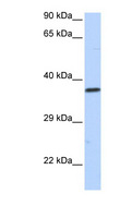 SCML1 Antibody - SCML1 antibody Western blot of HeLa lysate. This image was taken for the unconjugated form of this product. Other forms have not been tested.