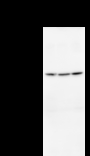 SCML2 Antibody - Detection of SCML2 by Western blot. Samples: Whole cell lysate from human HeLa (H, 25 ug) , mouse NIH3T3 (M, 25 ug) and rat F2408 (R, 25 ug) cells. Predicted molecular weight: 77 kDa