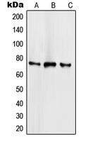 SCML2 Antibody - Western blot analysis of SCML2 expression in HeLa (A); NCIH460 (B); Jurkat (C) whole cell lysates.