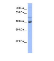 SCML4 Antibody - Western blot of Human NCI-H226 Whole cell . SCML4 antibody dilution 1.0 ug/ml.  This image was taken for the unconjugated form of this product. Other forms have not been tested.