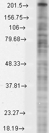 SCN10A / Nav1.8 Antibody - Western blot analysis of Nav1.8 in COS transient cells using a 1:1000 dilution of SCN10A / Nav1.8 antibody.  This image was taken for the unconjugated form of this product. Other forms have not been tested.