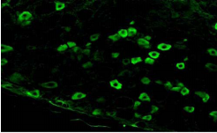 SCN10A / Nav1.8 Antibody - Immunofluorescent staining of rat dorsal root ganglia cryosections.