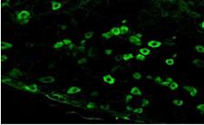 SCN10A / Nav1.8 Antibody - Immunofluorescent staining of rat dorsal root ganglia cryosections.