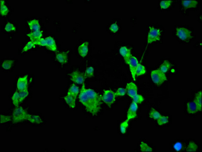 SCN10A / Nav1.8 Antibody - Immunofluorescence staining of SH-SY5Y cells at a dilution of 1:66, counter-stained with DAPI. The cells were fixed in 4% formaldehyde, permeabilized using 0.2% Triton X-100 and blocked in 10% normal Goat Serum. The cells were then incubated with the antibody overnight at 4 °C.The secondary antibody was Alexa Fluor 488-congugated AffiniPure Goat Anti-Rabbit IgG (H+L) .