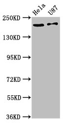 SCN10A / Nav1.8 Antibody - Positive Western Blot detected in Hela whole cell lysate, U87 whole cell lysate. All lanes: SCN10A antibody at 12 µg/ml Secondary Goat polyclonal to rabbit IgG at 1/50000 dilution. Predicted band size: 221 KDa. Observed band size: 221 KDa
