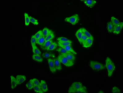 SCN11A / Nav1.9 Antibody - Immunofluorescence staining of HepG2 cells at a dilution of 1:166, counter-stained with DAPI. The cells were fixed in 4% formaldehyde, permeabilized using 0.2% Triton X-100 and blocked in 10% normal Goat Serum. The cells were then incubated with the antibody overnight at 4 °C.The secondary antibody was Alexa Fluor 488-congugated AffiniPure Goat Anti-Rabbit IgG (H+L) .