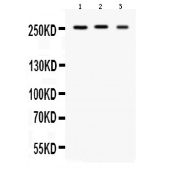 SCN1A / Nav1.1 Antibody - Western blot analysis of Scn1a expression in rat brain extract (lane 1), mouse brain extract (lane 2) and U87 whole cell lysates (lane 4). Scn1a at 250 kD was detected using rabbit anti- Scn1a Antigen Affinity purified polyclonal antibody at 0.5 ug/mL. The blot was developed using chemiluminescence (ECL) method.