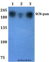 SCN1A / Nav1.1 Antibody - Western blot of SCN-pan antibody at 1:500 dilution. Lane 1: HEK293T whole cell lysate. Lane 2: RAW264.7 whole cell lysate.