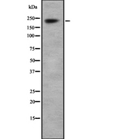 SCN1A / Nav1.1 Antibody - Western blot analysis Na+ CP type I alpha using HepG2 whole cells lysates