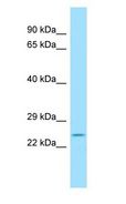 SCN1B Antibody - SCN1B antibody Western Blot of Rat Thymus.  This image was taken for the unconjugated form of this product. Other forms have not been tested.
