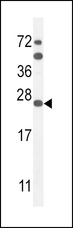 SCN1B Antibody - SCN1B Antibody western blot of mouse Neuro-2a cell line lysates (35 ug/lane). The SCN1B antibody detected the SCN1B protein (arrow).