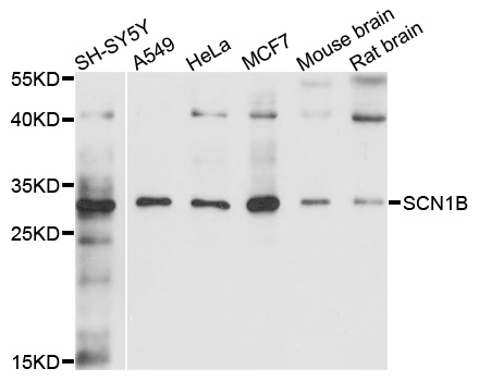 SCN1B Antibody - Western blot analysis of extracts of various cell lines, using SCN1B antibody at 1:1000 dilution. The secondary antibody used was an HRP Goat Anti-Rabbit IgG (H+L) at 1:10000 dilution. Lysates were loaded 25ug per lane and 3% nonfat dry milk in TBST was used for blocking. An ECL Kit was used for detection and the exposure time was 60s.