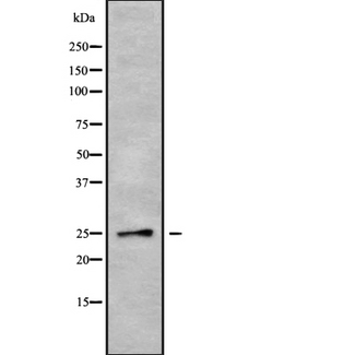 SCN1B Antibody - Western blot analysis SCN1B using HepG2 whole cells lysates
