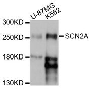 SCN2A / Nav1.2 Antibody - Western blot analysis of extracts of various cell lines, using SCN2A antibody at 1:1000 dilution. The secondary antibody used was an HRP Goat Anti-Rabbit IgG (H+L) at 1:10000 dilution. Lysates were loaded 25ug per lane and 3% nonfat dry milk in TBST was used for blocking. An ECL Kit was used for detection and the exposure time was 5s.