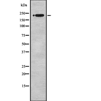 SCN2A / Nav1.2 Antibody - Western blot analysis Na+ CP type II alpha using Jurkat whole cells lysates