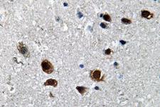 SCN2A / Nav1.2 Antibody - IHC of Na+ CP type II (K1032) pAb in paraffin-embedded human brain tissue.